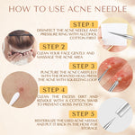 Dermated stainless steel pimple popper tools spread out