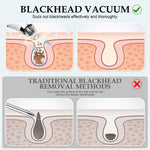 Close up of Flymooo electric pore cleaner device head
