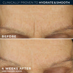 RoC pure retinol and hyaluronic acid skincare formula