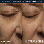 Back label view of RoC Retinol Correxion showcasing the key ingredients list and warnings