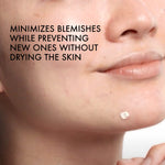 Authentic Vichy overnight blemish drying paste texture close up
