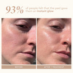 The complete Shani Darden two step resurfacing kit packaging including the exfoliating acids.