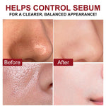 OEDPMFYL black rice pore cleaning liquid formula close up look