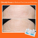 Dr. Dennis Gross dermatologist developed gentle peel pads for fine lines and pores