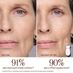 NuFACE face sculpting tool spheres contacting skin for a non invasive at home face lift treatment.