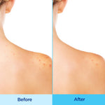 Differin Acne-Clearing Body Spray showing the three hundred and sixty degree continuous mist application design