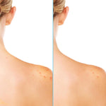 Differin Acne Body Spray bottle placed upright illustrating the lightweight fast drying texture