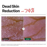 Dr. G brightening gel exfoliant for clearing blackheads and dead skin