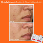 Dermatologist formulated Alpha Beta extra strength daily peel pads for oily skin treatment