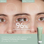 Caudalie gel cleanser for acne prone skin texture preview