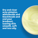 De La Cruz sulfur ointment packaging showing 10 percent maximum strength