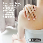 Compact travel size acne treatment ointment by De La Cruz