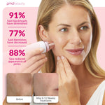 PMD Beauty Personal Microderm Pro kit with power adapter and accessories