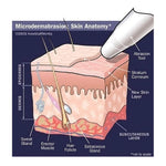 NeedCrystals natural facial exfoliating treatment fine white crystals for clinical machines
