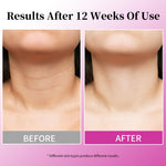 Mrlilei lifting cream for sagging skin on counter