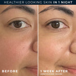 Hypoallergenic night cream by RoC for sensitive skin barrier recovery