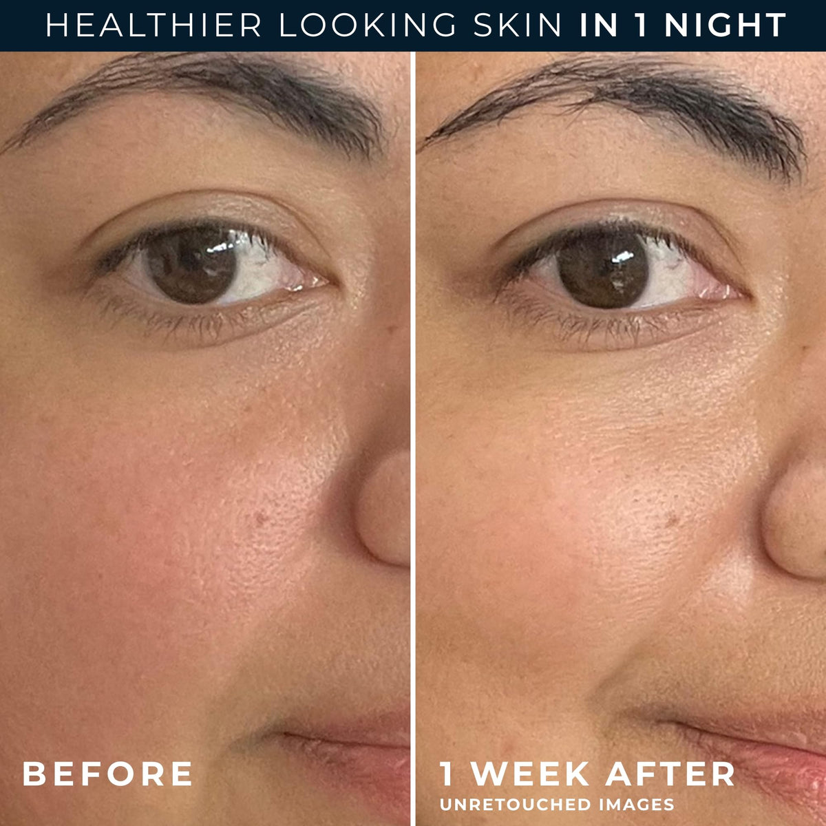Hypoallergenic night cream by RoC for sensitive skin barrier recovery