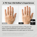 DOMINAS Tranexamic Acid Cream 1.76 Ounce tub displaying pharmaceutical grade dark spot corrector branding.