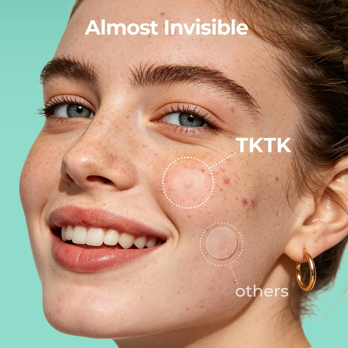 TKTK hydrocolloid acne stickers size comparison 10mm and 12mm