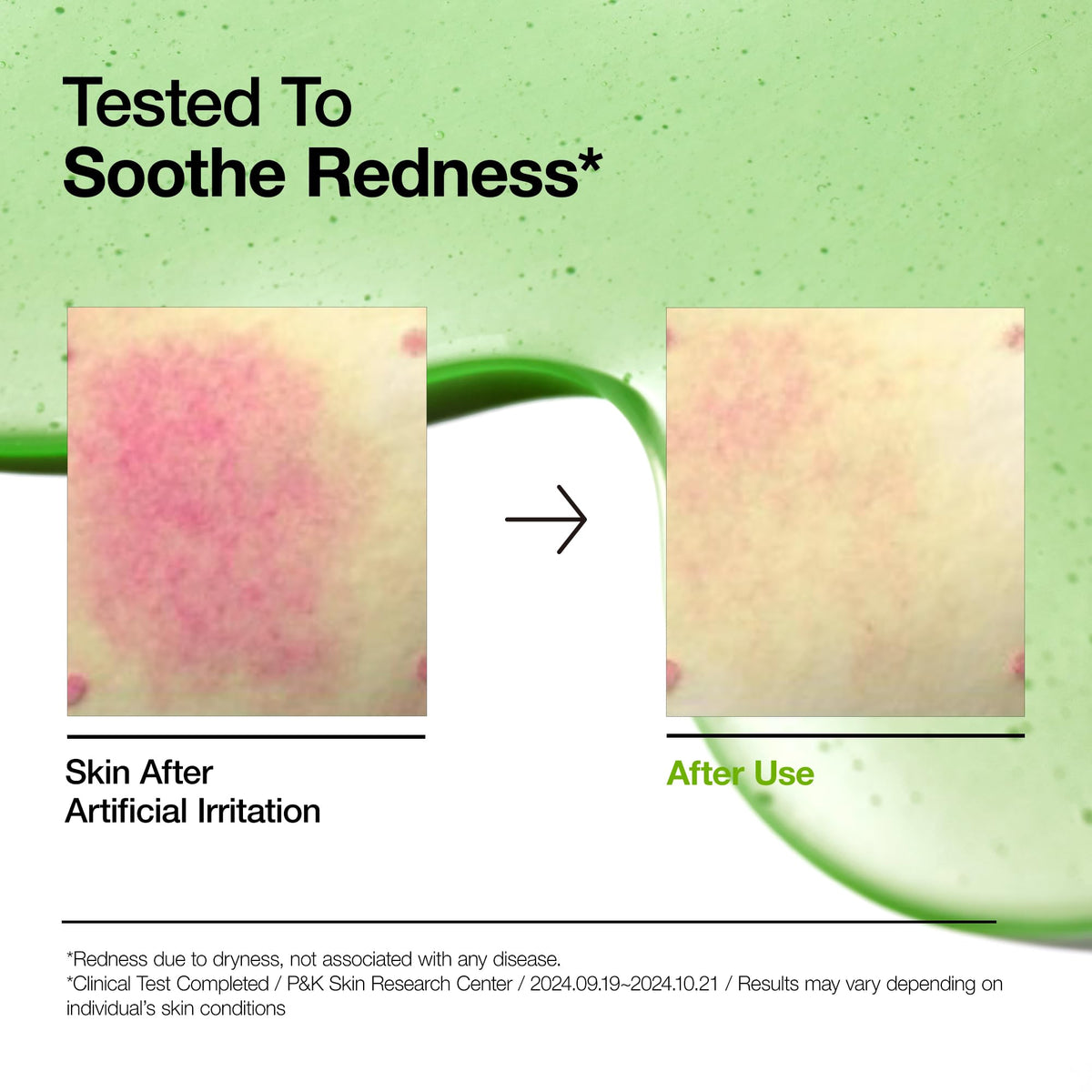 Full layout of the Anua soothing skincare set with all three bottles arranged chronologically by step