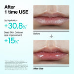 Anua lip treatment applied as an overnight lip mask for cracked lips.