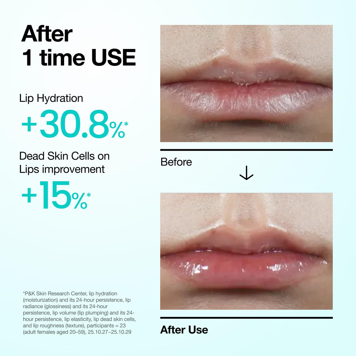 Anua lip treatment applied as an overnight lip mask for cracked lips.