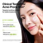 Anua three percent azelaic acid and cica cream packaging