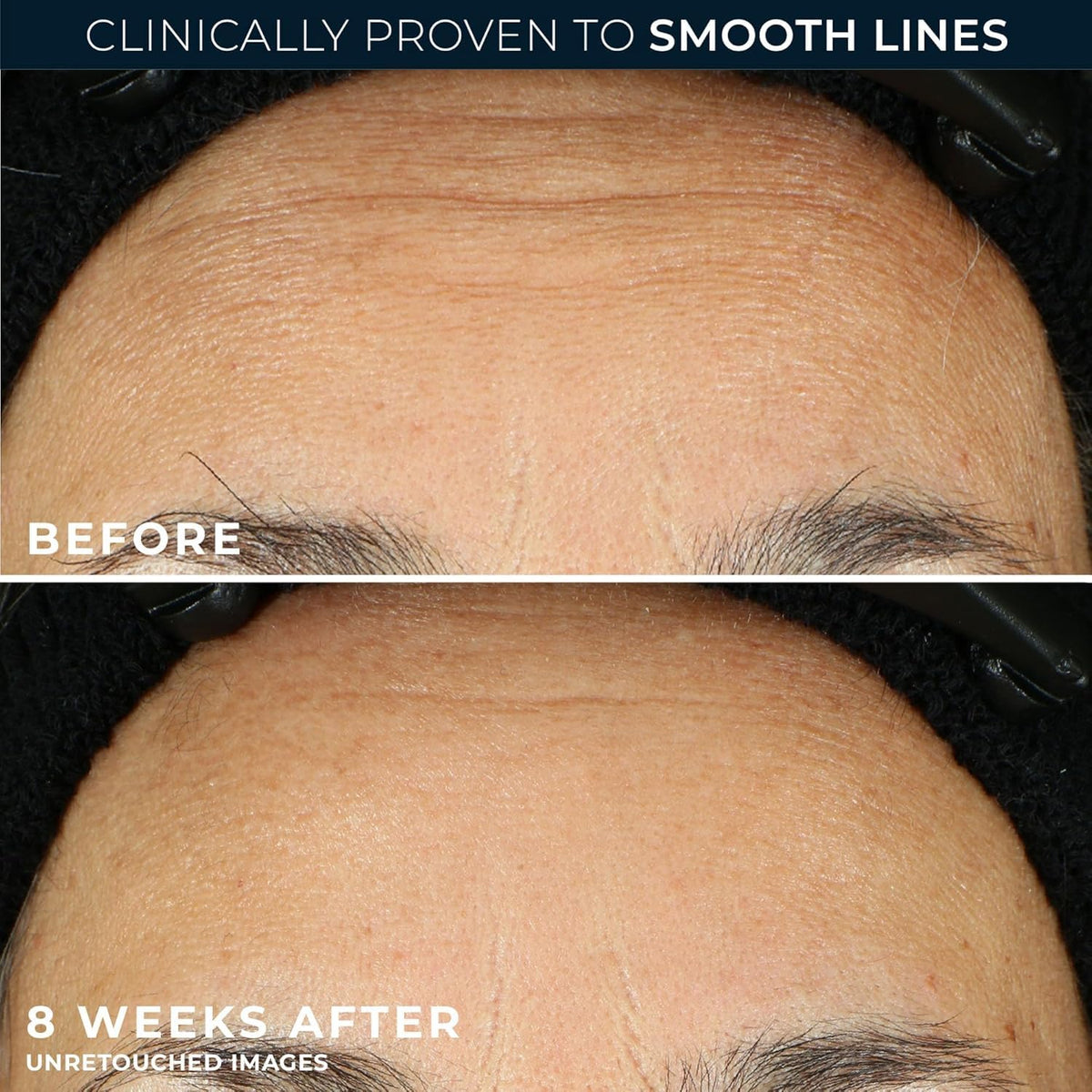 RoC line smoothing daily skincare routine capsules application