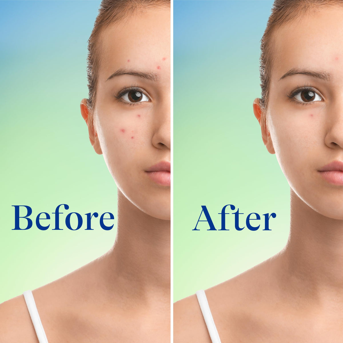 Close up of Differin acne foaming cleanser design showing maximum strength formulation details