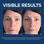 Skincare routine display featuring L'Oreal Paris retinol moisturizer and sample serum bottle