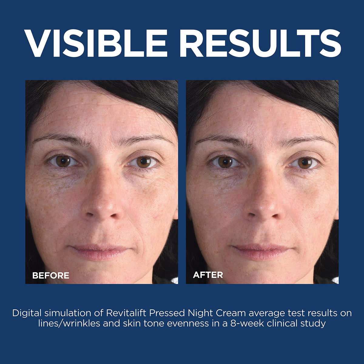 Skincare routine display featuring L'Oreal Paris retinol moisturizer and sample serum bottle