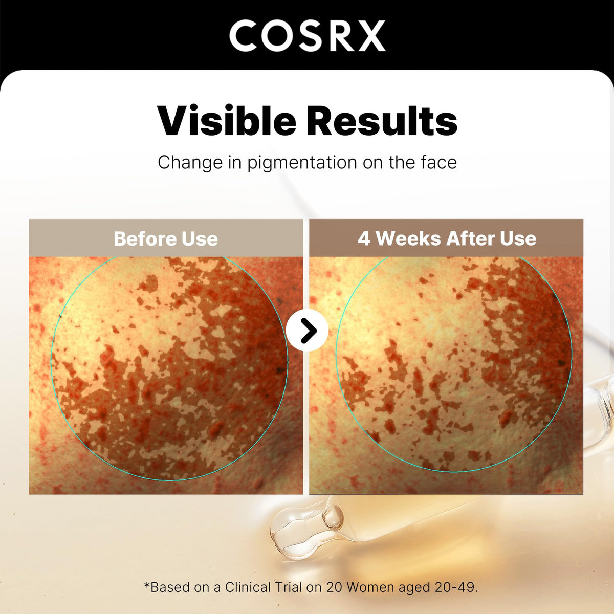COSRX Korean skincare discoloration treatment serum being applied with a dropper