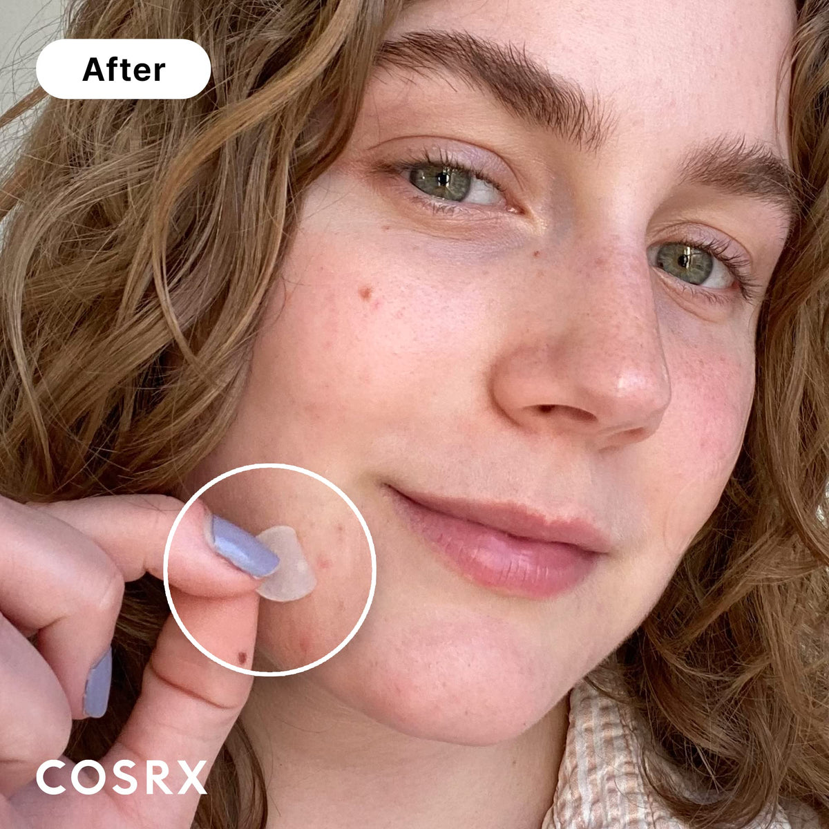COSRX spot treatment patches showing three different sizes of circular hydrocolloid dots on a clear backing sheet