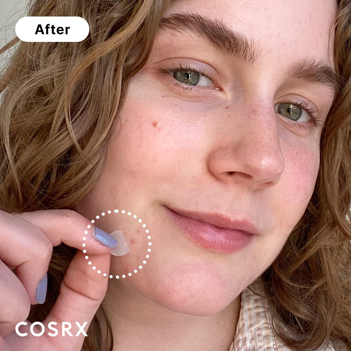 COSRX acne spot treatment sheets showing three different sizes of transparent pimple stickers.