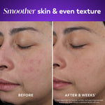Olay Retinol Night Cream for women with Vitamin B3 and Peptide matrix graphics