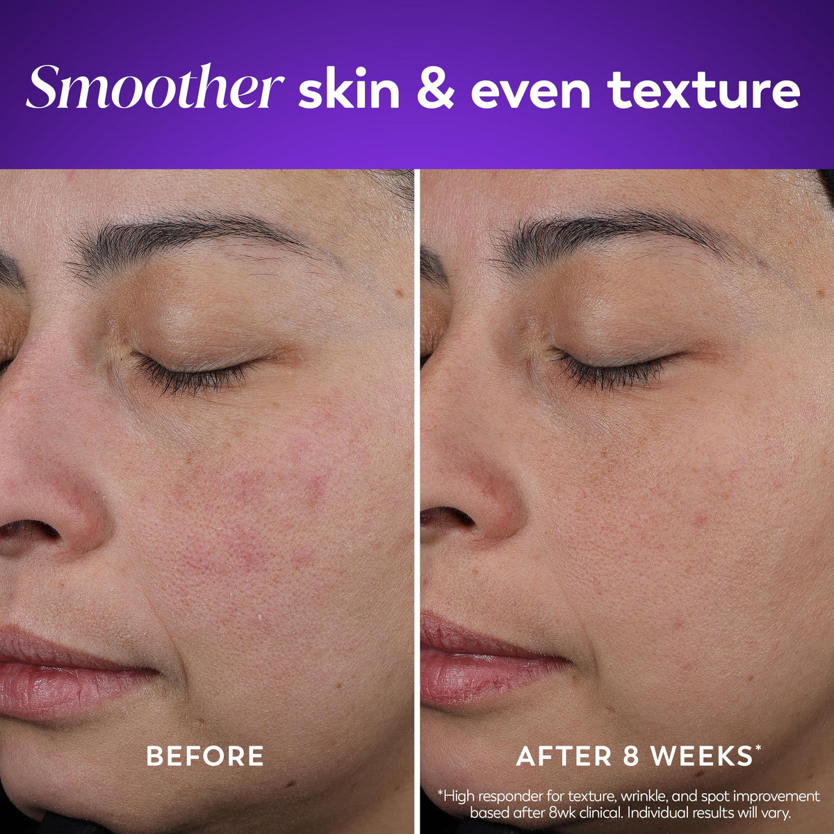 Olay Retinol Night Cream for women with Vitamin B3 and Peptide matrix graphics