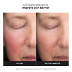Fragrance free water light liquid exfoliant formula by Paula's Choice for correcting uneven skin tone