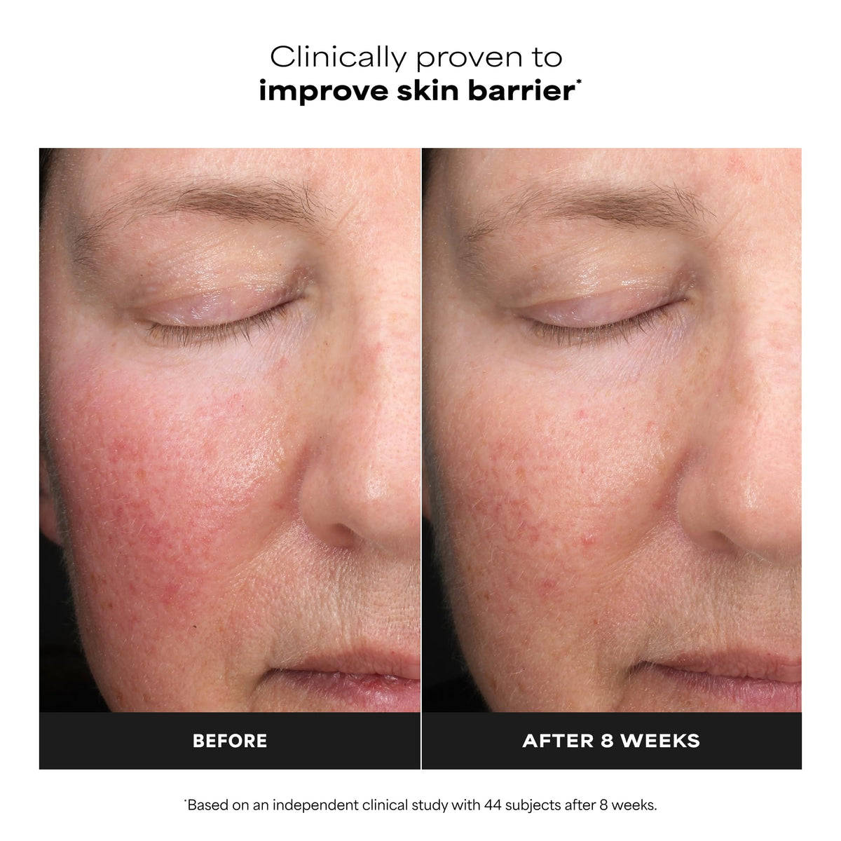 Fragrance free water light liquid exfoliant formula by Paula's Choice for correcting uneven skin tone