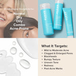Paula's Choice CLEAR benzoyl peroxide acne skin clearing treatment tube for breakout control.