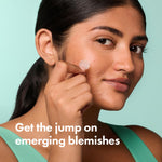 Close up of the sealed easy to peel sheet containing eight hydrocolloid acne spot treatment patches