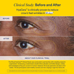 Ritual HyaCera clinically proven wrinkle support packaging