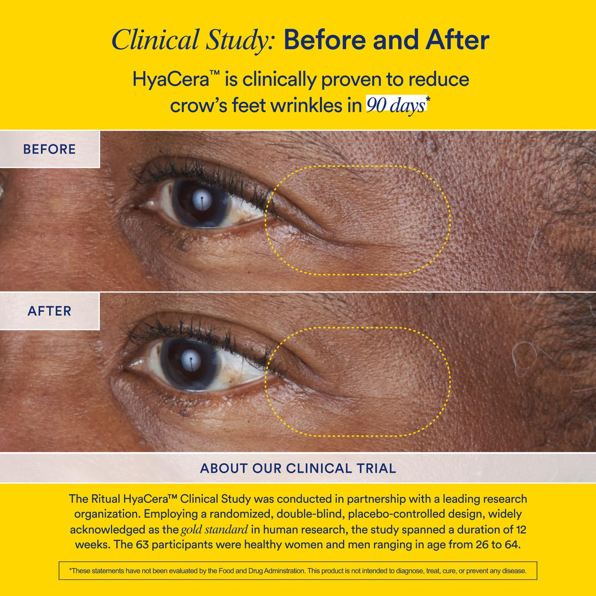 Ritual HyaCera clinically proven wrinkle support packaging