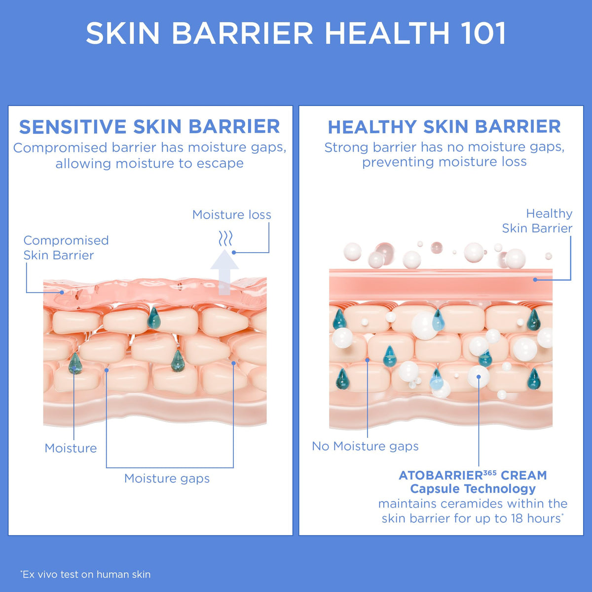 Dermatologist tested moisturizer for sensitive skin side angle view