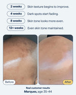 Texture shot of Remedy Science discoloration night treatment gel lotion on a white background