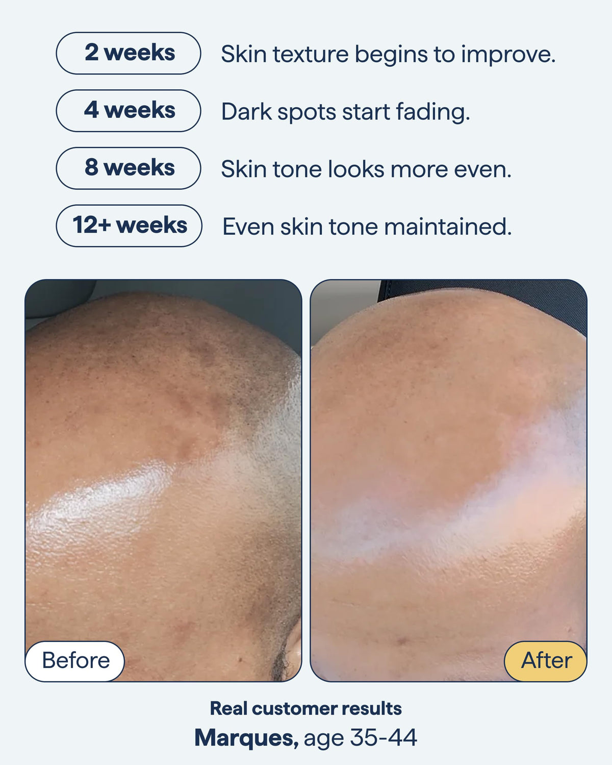 Texture shot of Remedy Science discoloration night treatment gel lotion on a white background