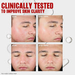 Thayers Blemish Clearing Toner texture and application