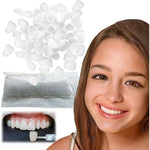 VEZE Provisional Tooth Repair Kit front view showcasing the packaging and temporary dental beads.
