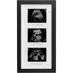HAMUIERS ultrasound picture frame front view showing triple sonogram layout in black wood.