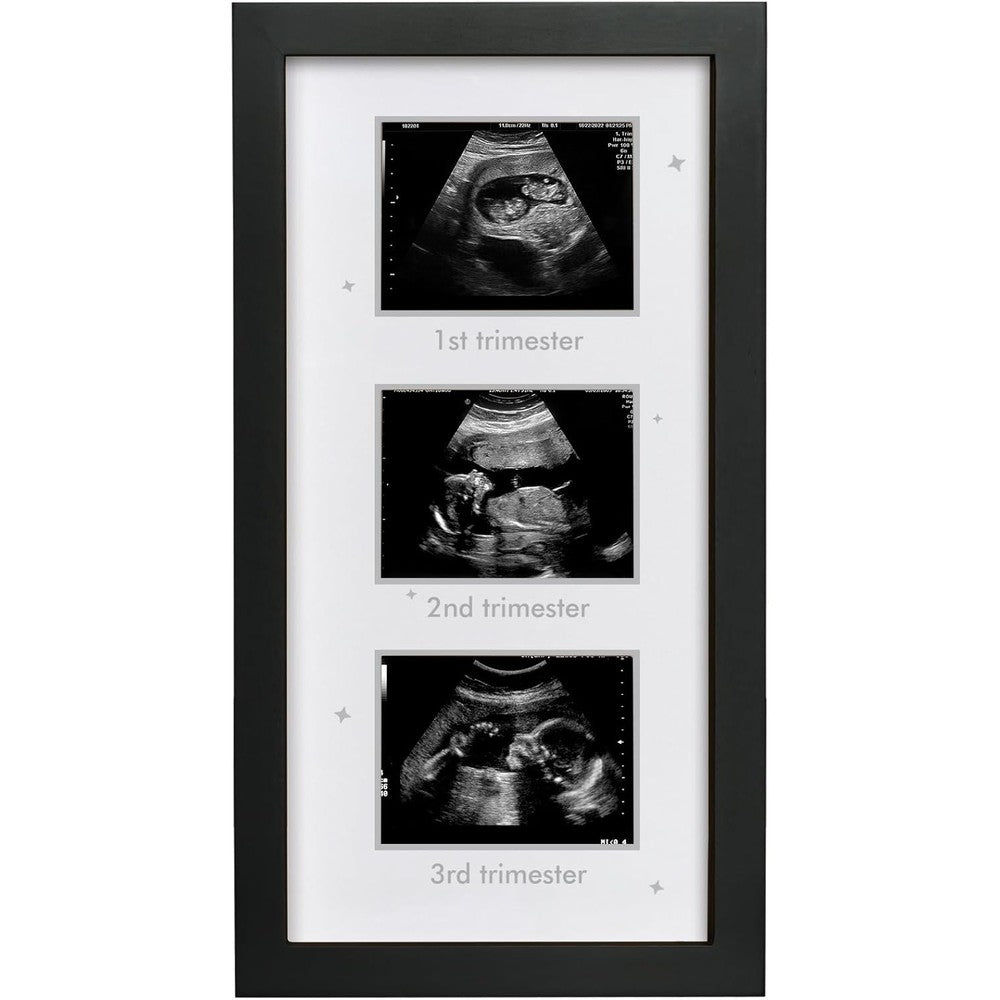 HAMUIERS ultrasound picture frame front view showing triple sonogram layout in black wood.