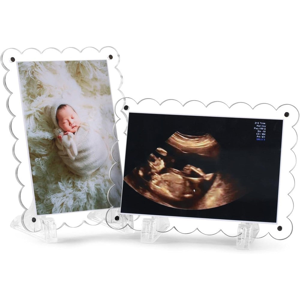 Mlatnod dual magnetic sonogram picture frame front view showing a clear acrylic scalloped edge holding a baby ultrasound scan photo.